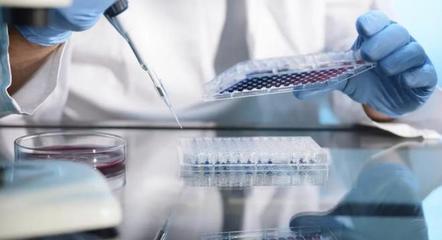 國內(nèi)細(xì)胞治療產(chǎn)品審批提速 載體制造如何擺脫"被動(dòng)追趕"局面?